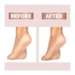 Pretty Girl Flawless Pedi Electronic Pedicure Tool – Rechargeable Callus Remover with LED Light, 2 Speeds & Roller Heads