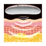 Smart Heating Waist Belt – Warm Abdominal Therapy Belt for Comfort & Relaxation (Pink)