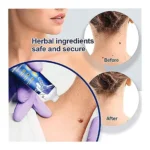 Instant Blemish Care Cream – Skin Appearance Smoothing Ointment for Face & Body (1PC, 20g)